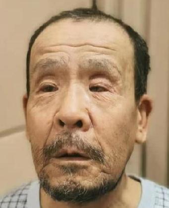 走失者照片 全国救助站