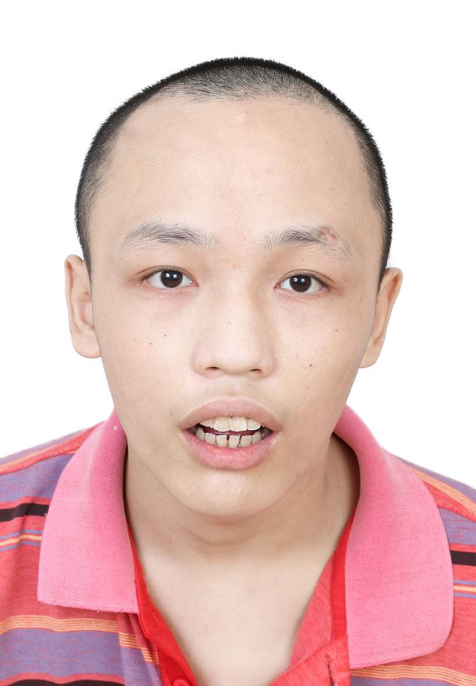 走失者照片 全国救助站