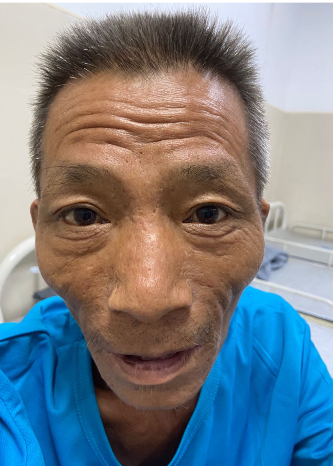 走失者照片 全国救助站