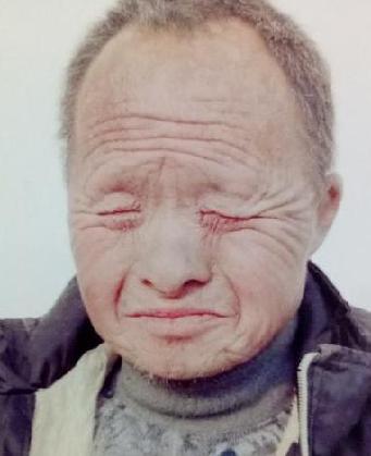 走失者照片 全国救助站