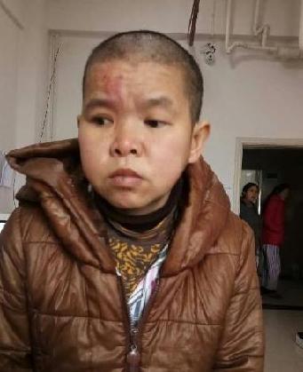 走失者照片 全国救助站