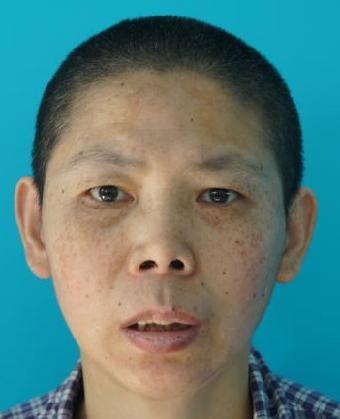 走失者照片 全国救助站