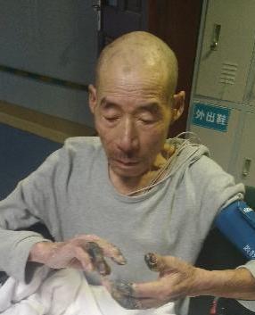 走失者照片 全国救助站