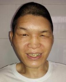 走失者照片 全国救助站