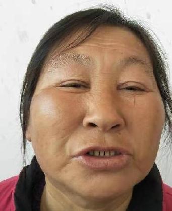 走失者照片 全国救助站