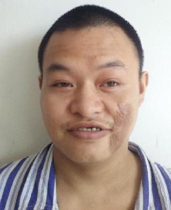 走失者照片 全国救助站