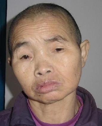 走失者照片 全国救助站