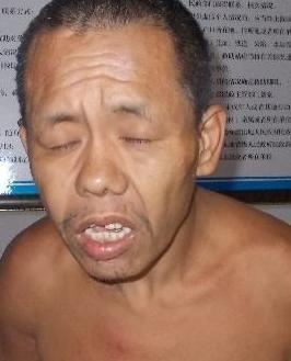 走失者照片 全国救助站