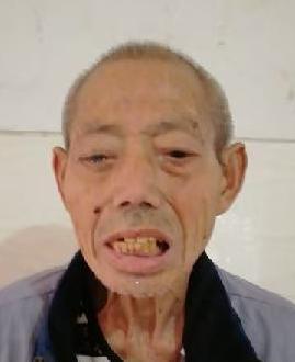 走失者照片 全国救助站