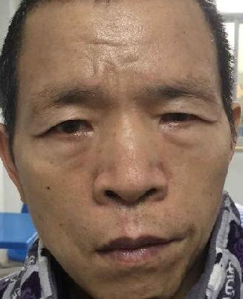 走失者照片 全国救助站