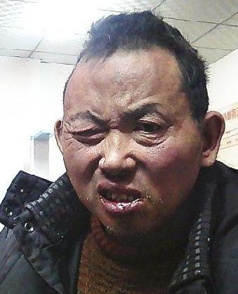 走失者照片 全国救助站