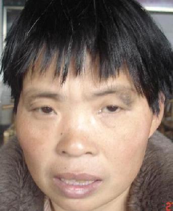走失者照片 全国救助站
