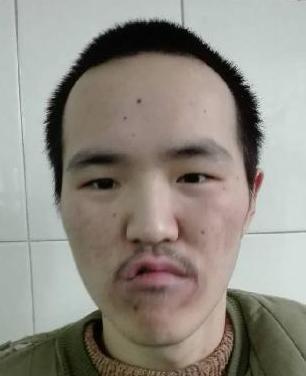 走失者照片 全国救助站