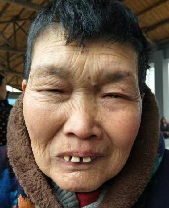 走失者照片 全国救助站
