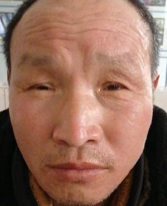 走失者照片 全国救助站