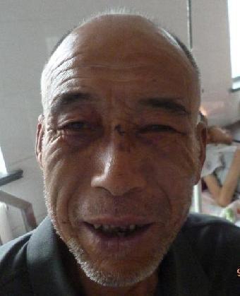 走失者照片 全国救助站