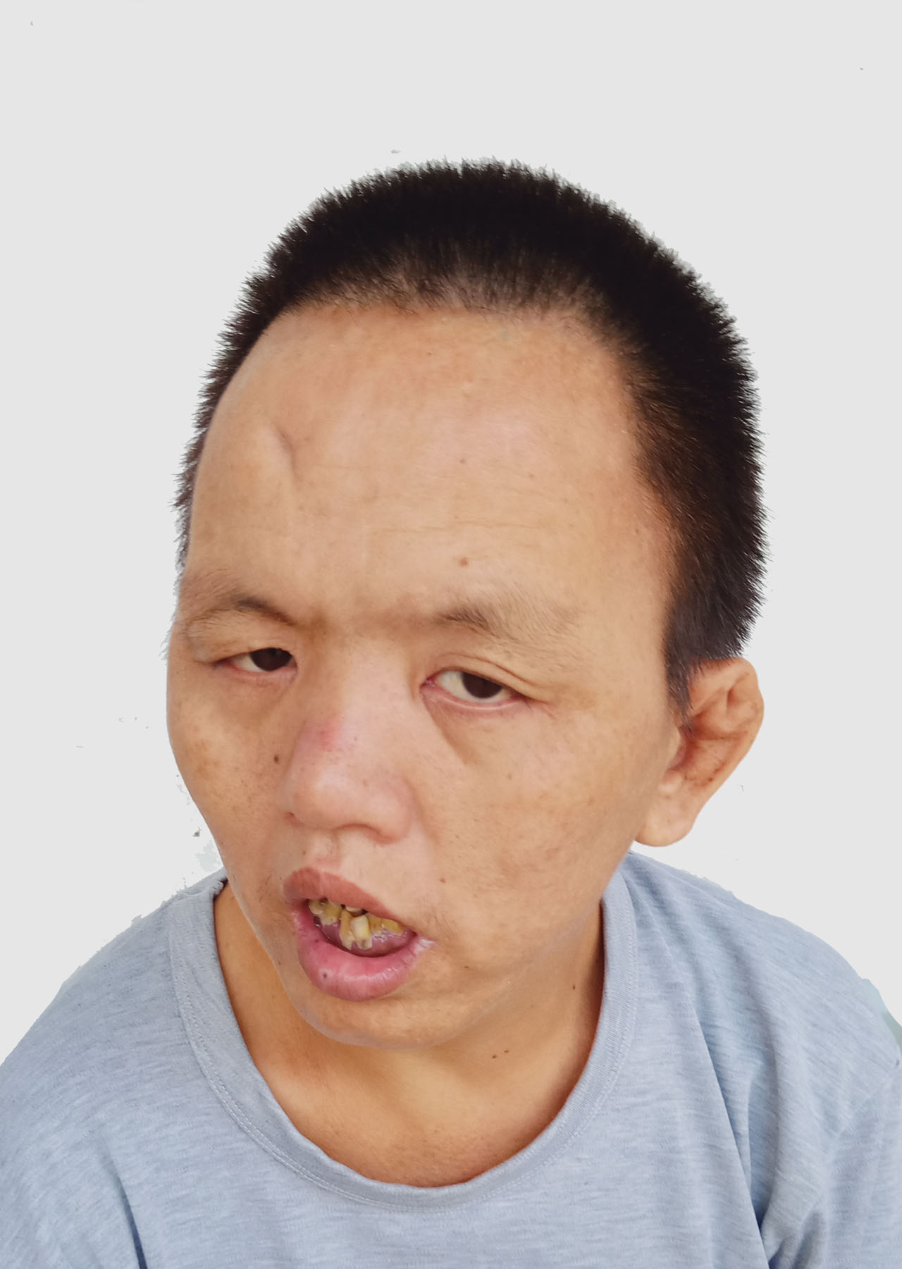 走失者照片 全国救助站