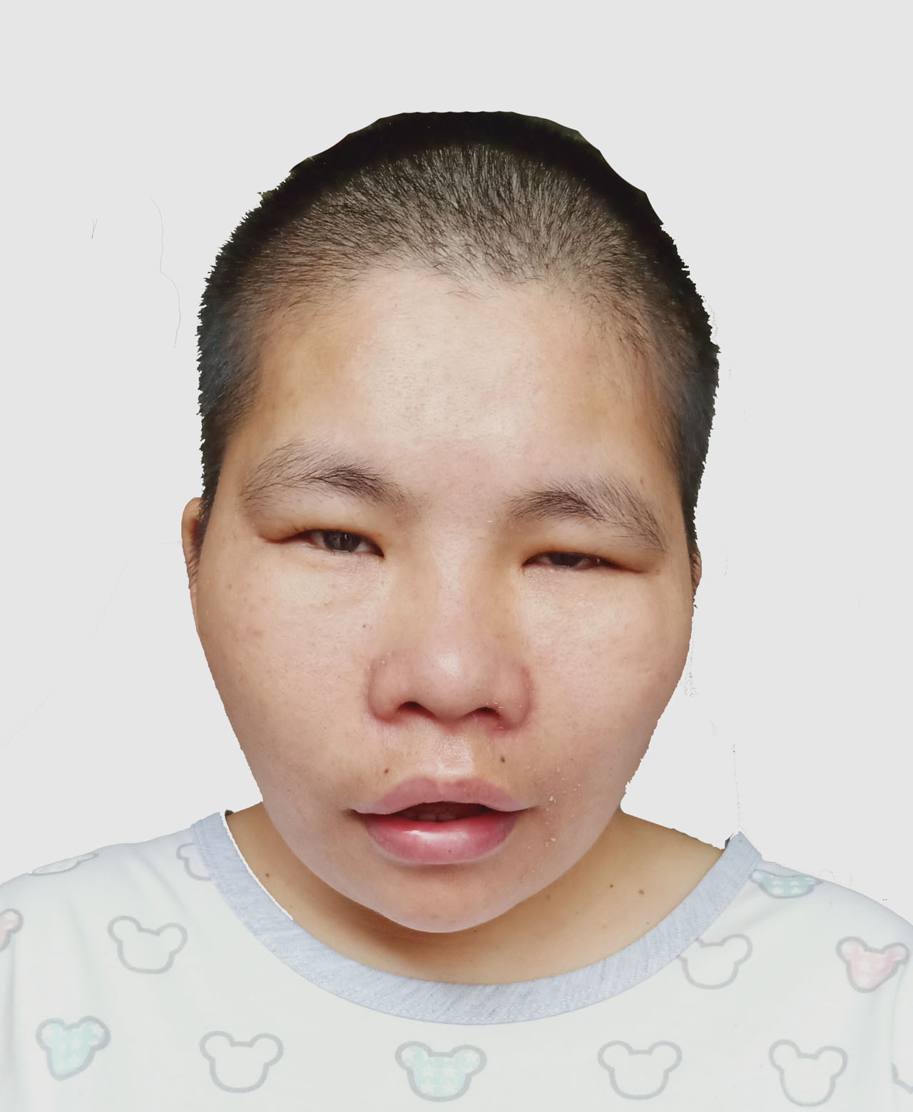 走失者照片 全国救助站