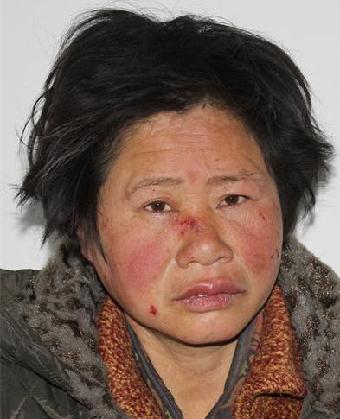 走失者照片 全国救助站