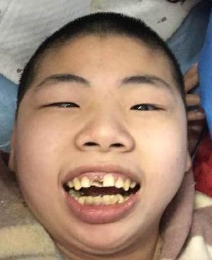走失者照片 全国救助站