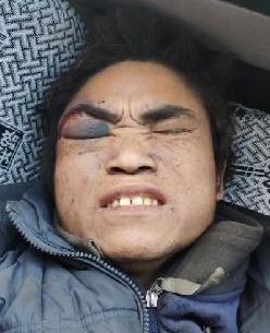 走失者照片 全国救助站