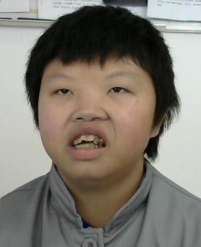 走失者照片 全国救助站