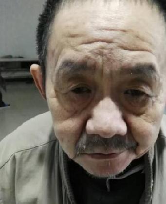 走失者照片 全国救助站