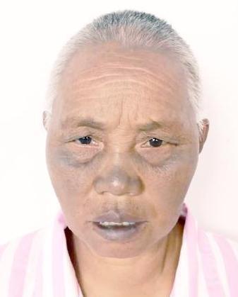 走失者照片 全国救助站