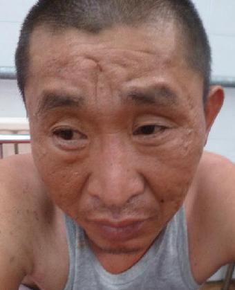 走失者照片 全国救助站