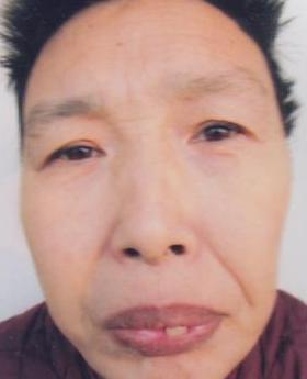 走失者照片 全国救助站