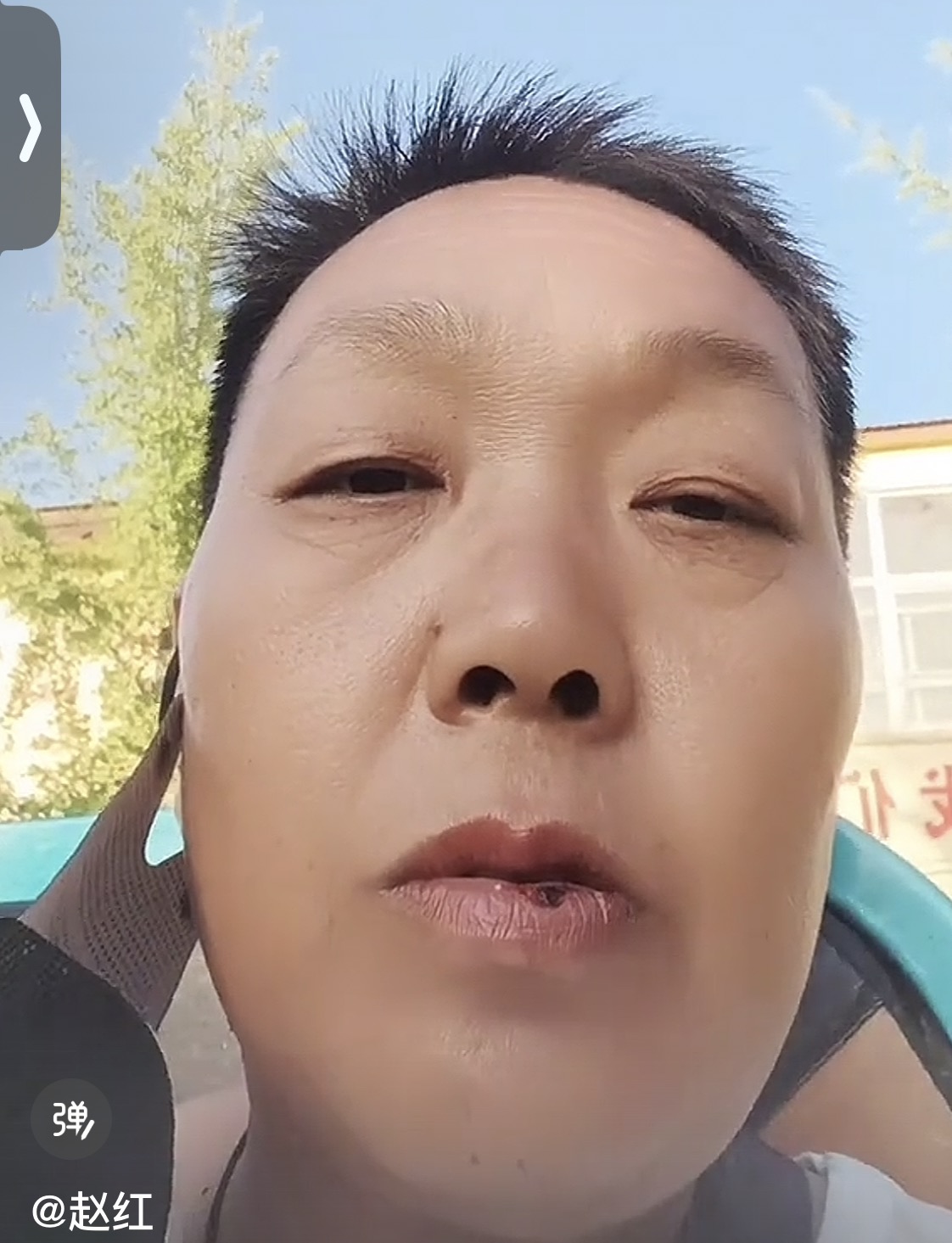 走失者照片 这是我的母亲，走路左脚有问题和脑袋...