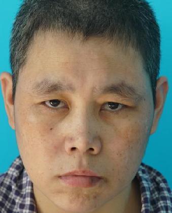 走失者照片 全国救助站