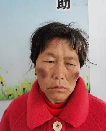 走失者照片 全国救助站