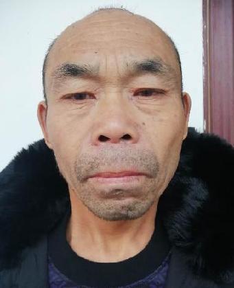 走失者照片 全国救助站