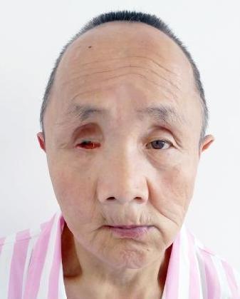 走失者照片 全国救助站
