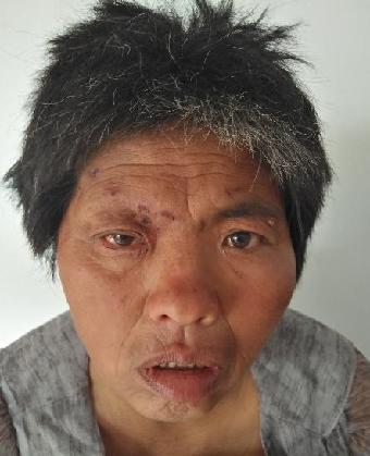 走失者照片 全国救助站