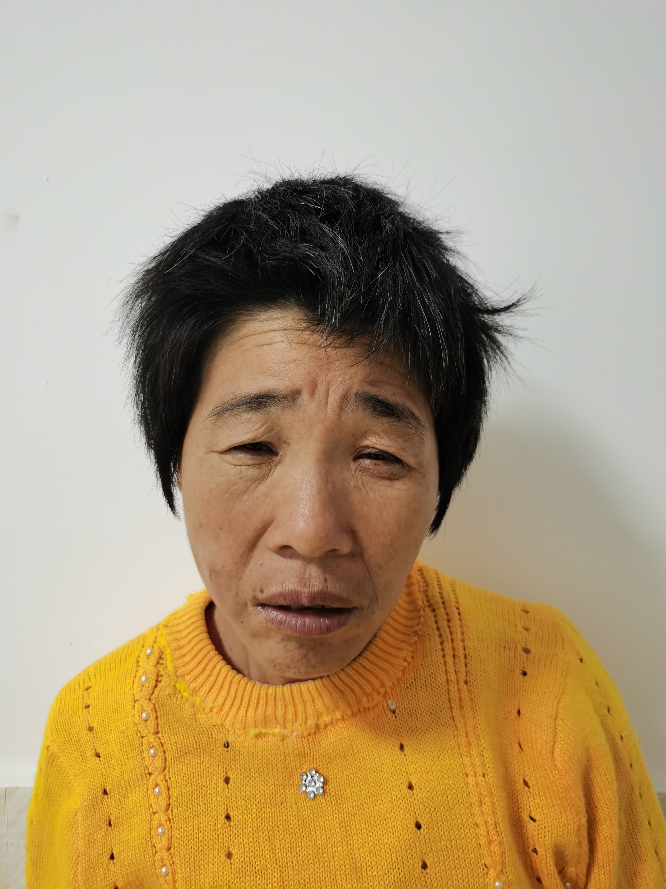 走失者照片 全国救助站