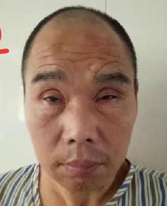 走失者照片 全国救助站