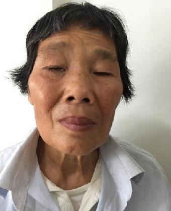 走失者照片 全国救助站