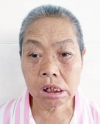 走失者照片 全国救助站
