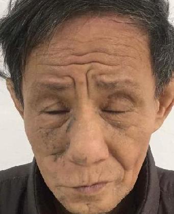 走失者照片 全国救助站