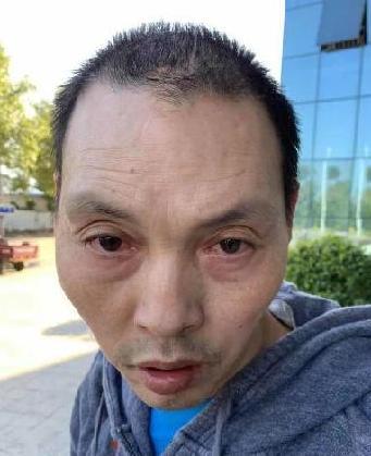 走失者照片 全国救助站