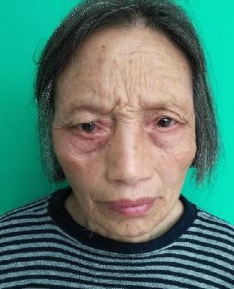 走失者照片 全国救助站
