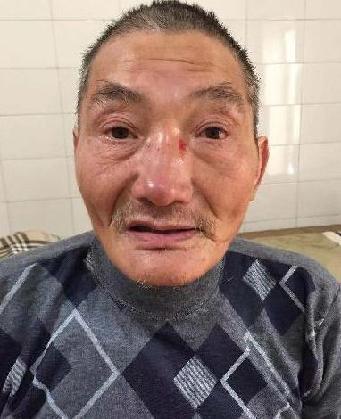 走失者照片 全国救助站