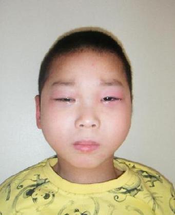 走失者照片 全国救助站