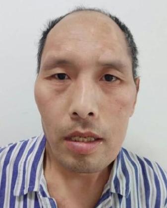 走失者照片 全国救助站