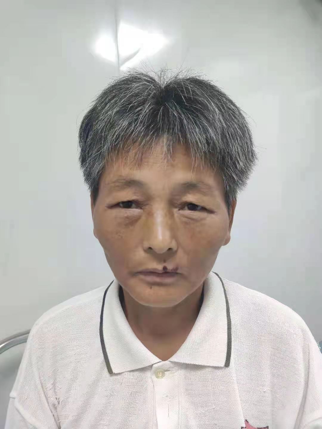 走失者照片 全国救助站