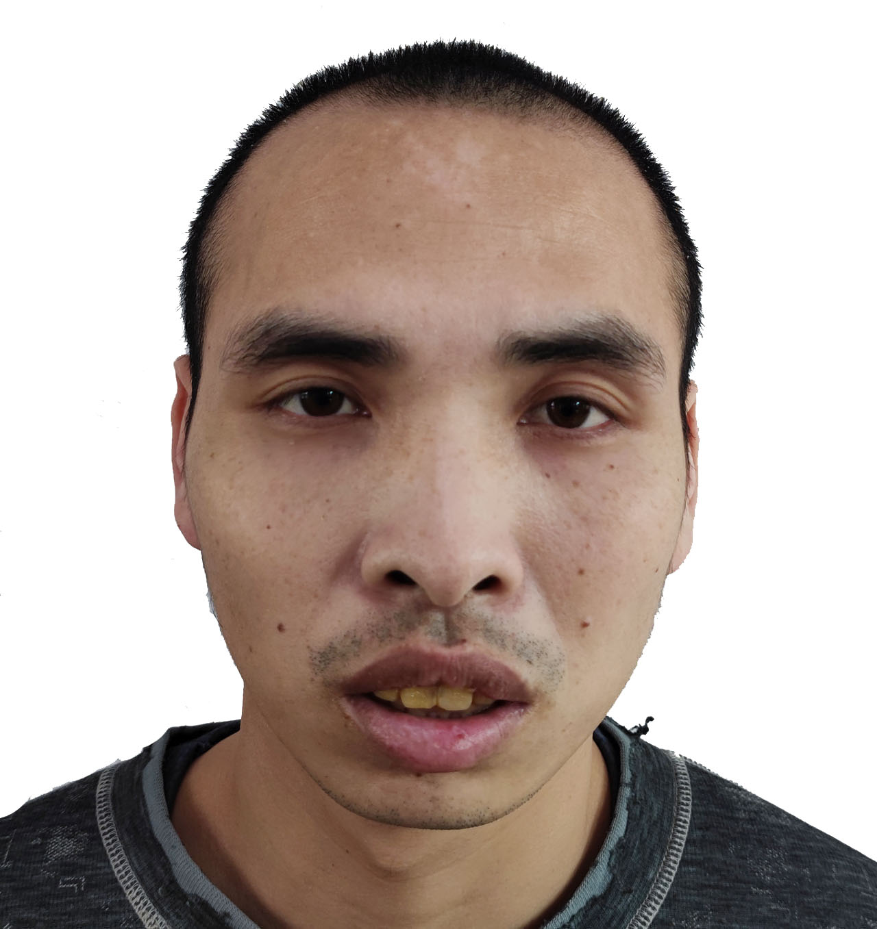 走失者照片 全国救助站