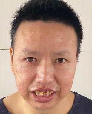 走失者照片 全国救助站