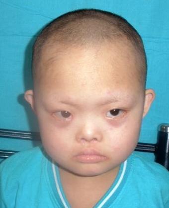 走失者照片 全国救助站